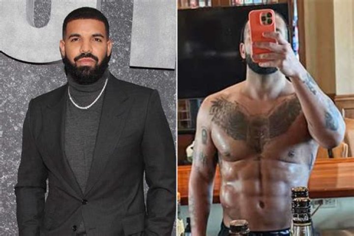 Drake | Surgery Rumors 2024