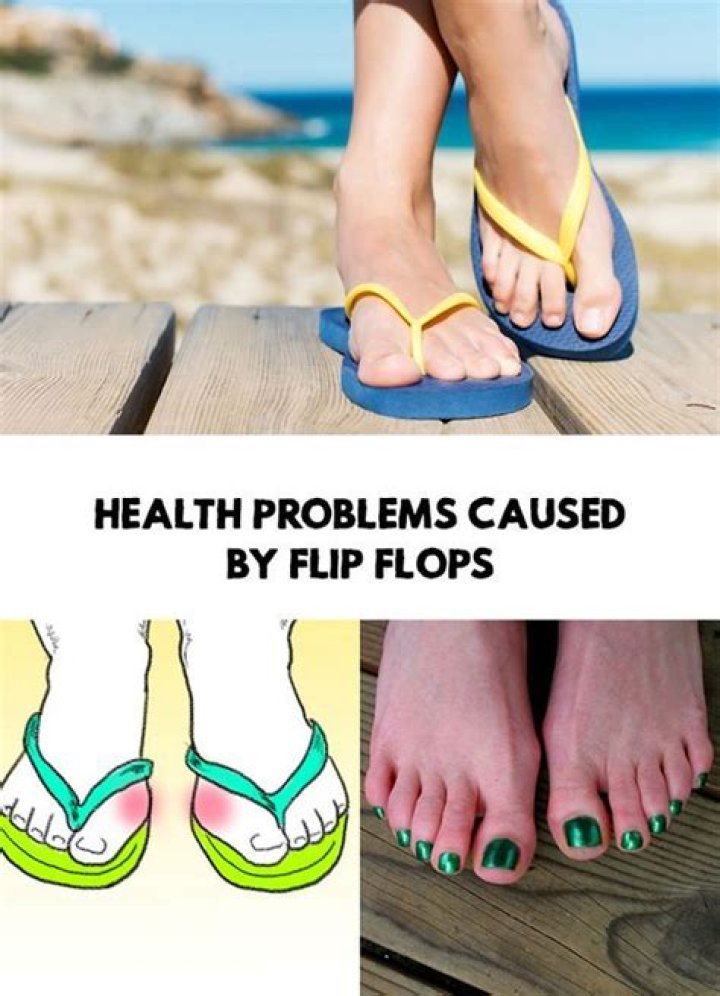 Seriously Gross Flip-Flops - GirlsLife