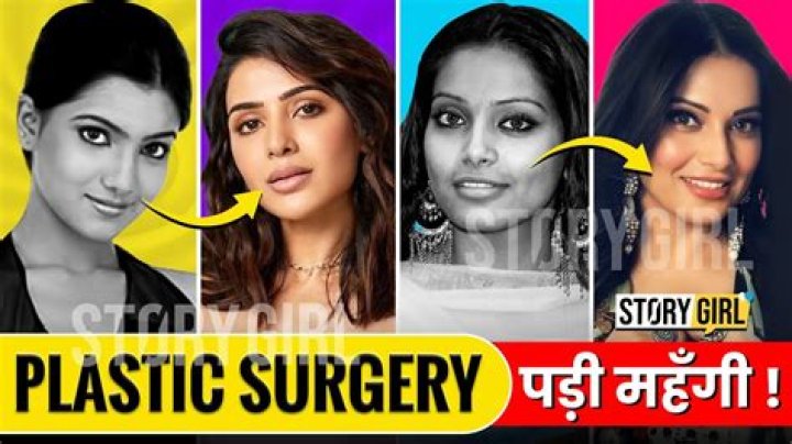 Honey Rose | Health Update: Has She Done Plastic Surgery?