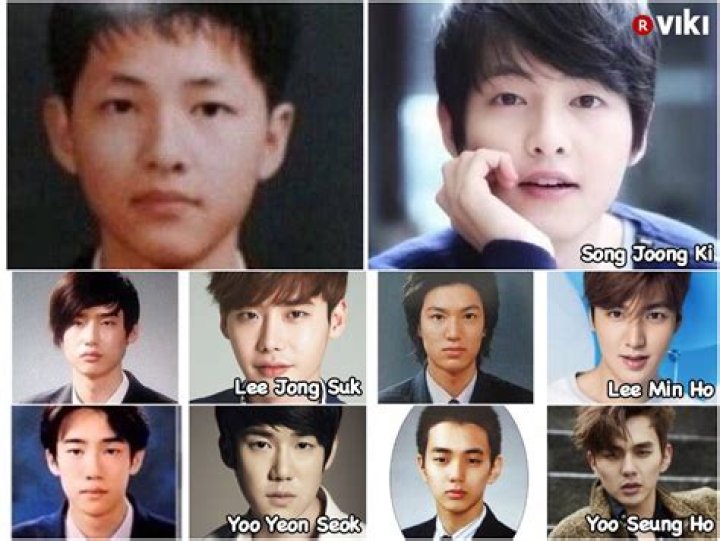 How Does Lee Jong Suk Before Plastic Surgery | What Is Wrong With His Face