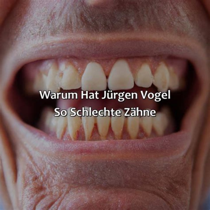 Jürgen Vogel Fortune