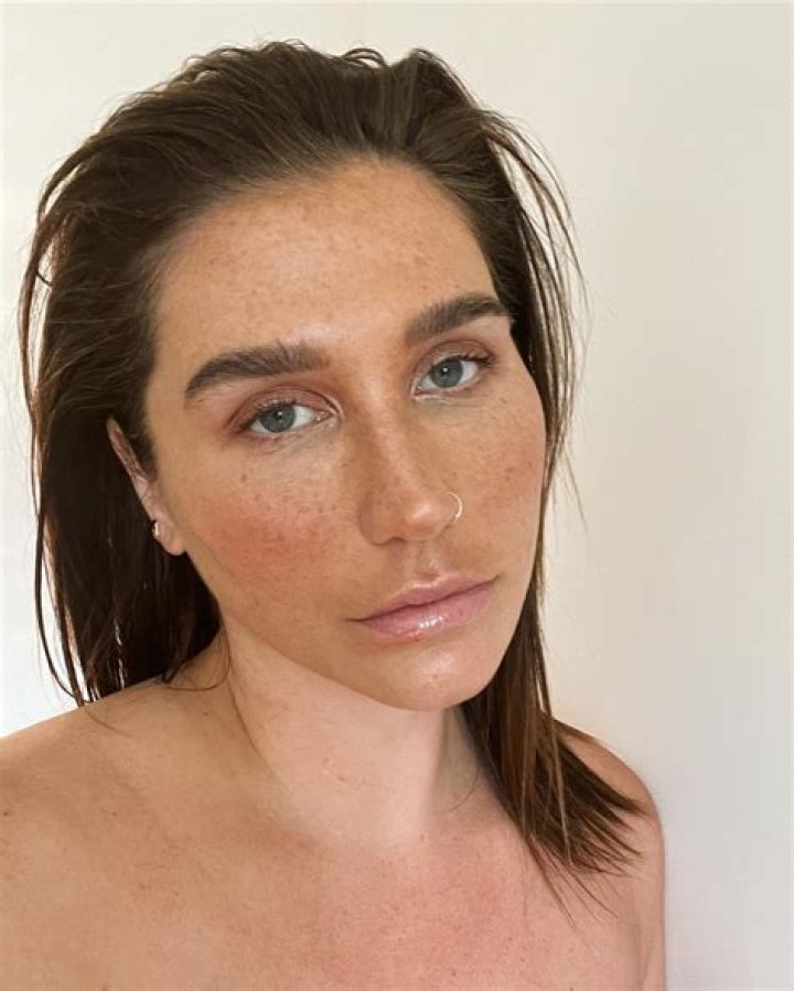 Kesha Nude Photo On Instagram – Pimps Herself Again After Plastic Surgery (PHOTOS)