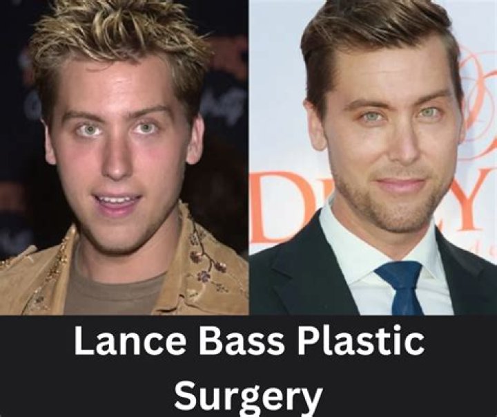 Lance Bass Plastic Surgery | Before And After Photos